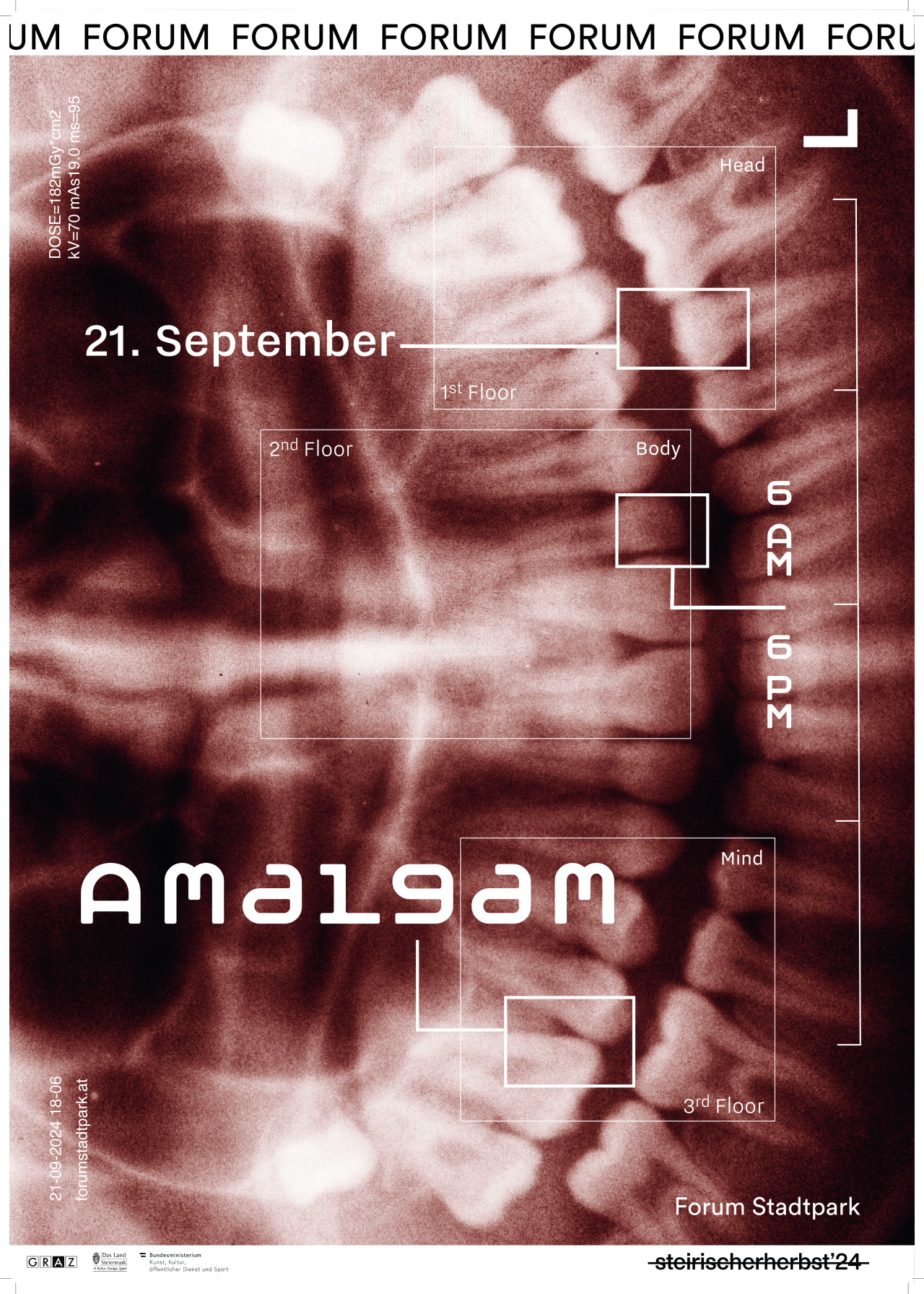 AMALGAM